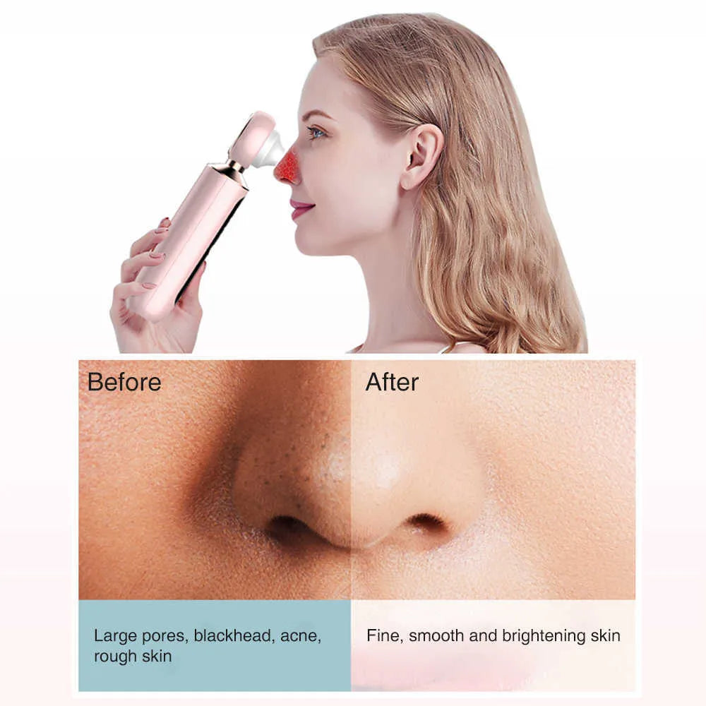 ʜᴏᴍᴇ ᴢᴇɴɪᴛʜ™ Blackhead Suction Machine