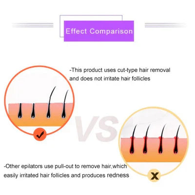 ʜᴏᴍᴇ ᴢᴇɴɪᴛʜ™Purple Epilator – آلة إزالة الشعر البنفسجية