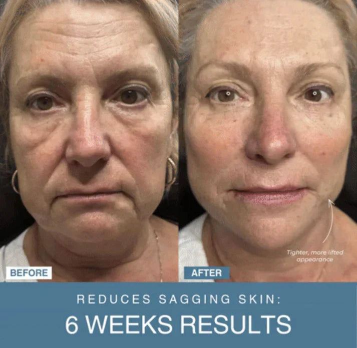 ʜᴏᴍᴇ ᴢᴇɴɪᴛʜ™ 7-in-1 LED Anti-Aging/Wrinkle Apparatus