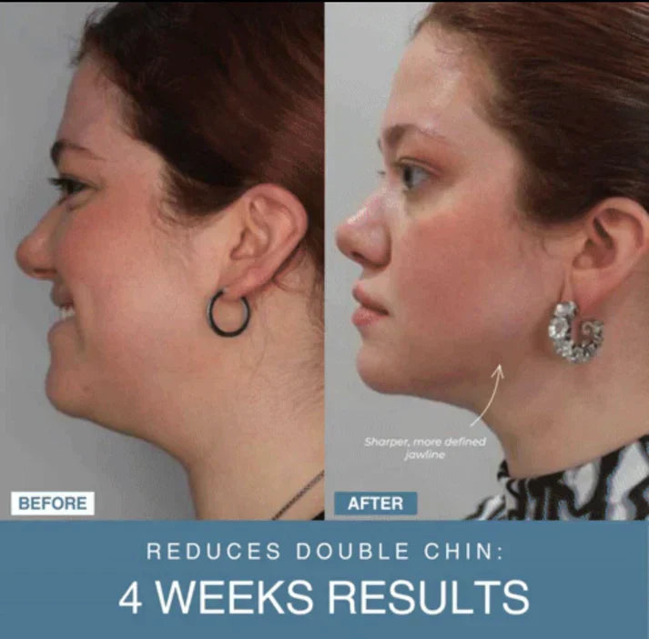 ʜᴏᴍᴇ ᴢᴇɴɪᴛʜ™ 7-in-1 LED Anti-Aging/Wrinkle Apparatus