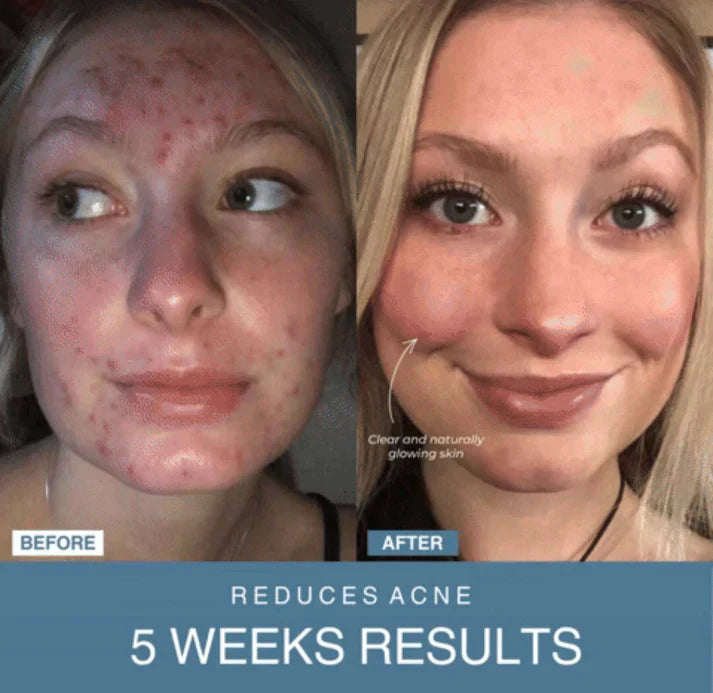 ʜᴏᴍᴇ ᴢᴇɴɪᴛʜ™ 7-in-1 LED Anti-Aging/Wrinkle Apparatus
