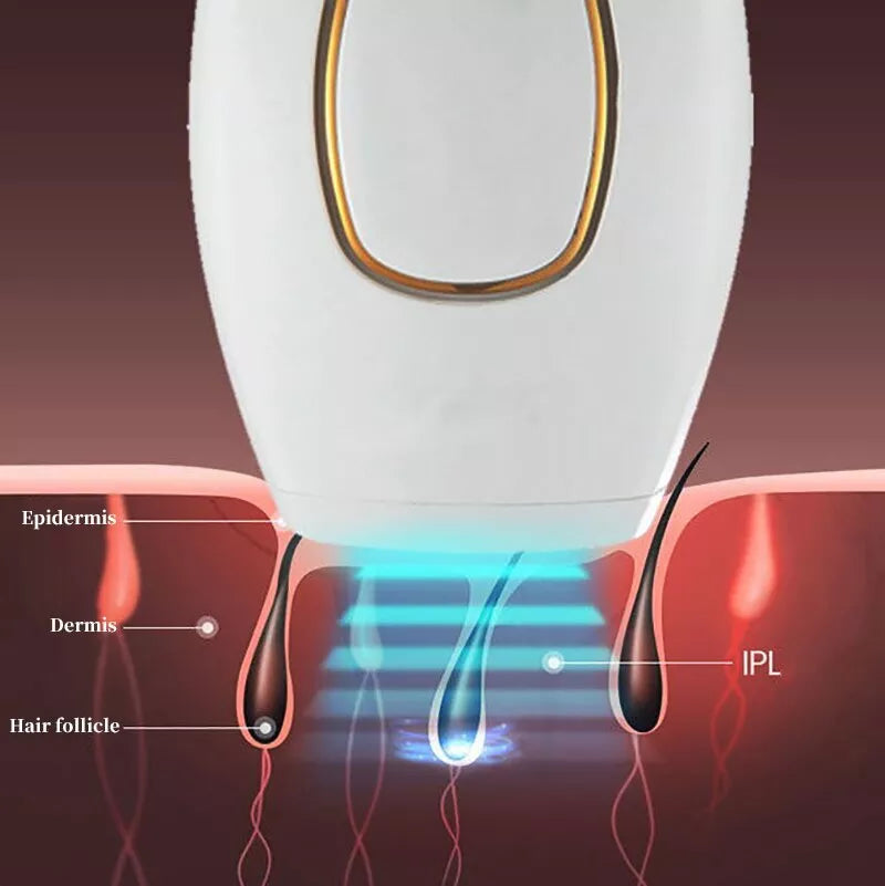 ʜᴏᴍᴇ ᴢᴇɴɪᴛʜ™ IPL Laser Hair Removal – جهاز إزالة الشعر بالليزر IPL